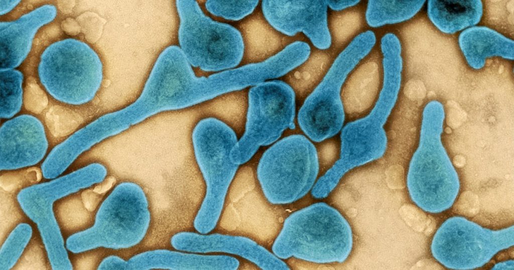 WHO says at least 8 dead in suspected Marburg outbreak in Tanzania | Health News