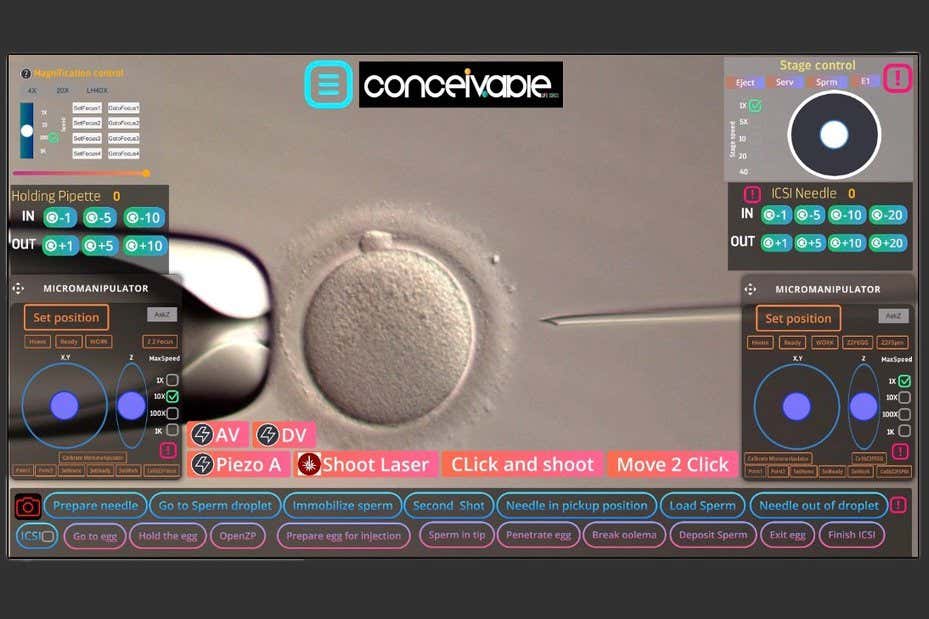 World’s first baby born by IVF done almost entirely by a machine