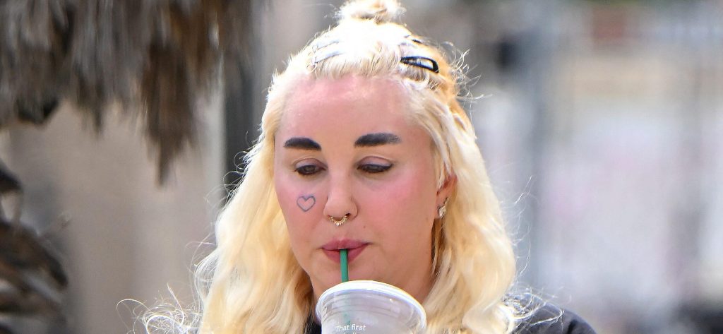 Amanda Bynes Flaunts Her Fresh Lip Injections In New Video