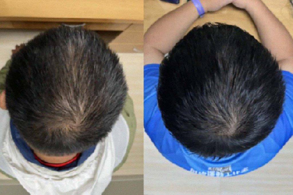 Serum based on plant extracts boosts hair growth in weeks