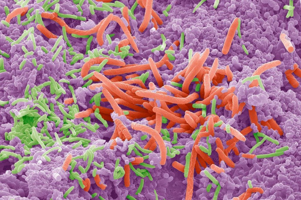 Your oral microbiome could affect your weight, liver and diabetes risk