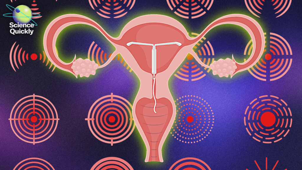 One doctor’s fight to make IUD placement better